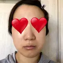 骨切り（あご） / 骨削り（エラ） リラ・クラニオフェイシャル・クリニック DAY 63 サムネイル用