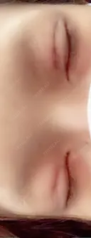 二重埋没 メディカルビューティセンター DAY 1 サムネイル用