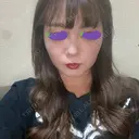 脂肪吸引（顔） 表参道スキンクリニック 表参道院 DAY 115 サムネイル用