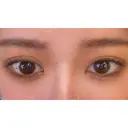 二重切開 / タレ目形成・グラマラスライン（切開） ハナキクリニック DAY 53 サムネイル用