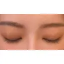 二重切開 / タレ目形成・グラマラスライン（切開） ハナキクリニック DAY 53 サムネイル用