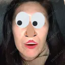 ボトックス（エラ・小顔） 湘南美容クリニック 藤沢院 DAY 19 サムネイル用