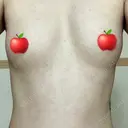 豊胸（脂肪注入） ヴェルトラクリニック 大阪院 DAY 33 サムネイル用