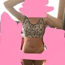 脂肪吸引（お腹） / その他（ボディ） ザ・セロイ美容外科医院 DAY 136 サムネイル用