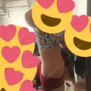 脂肪吸引（お腹） / その他（ボディ） ザ・セロイ美容外科医院 DAY 136 サムネイル用