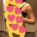 脂肪吸引（二の腕） ラインカルチャークリニック DAY 163 サムネイル用