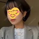 糸リフト / 脂肪吸引（顔） / その他（肌） ビューティーライン美容外科 AFTER サムネイル用