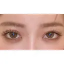 二重切開 / タレ目形成・グラマラスライン（切開） ハナキクリニック DAY 62 サムネイル用