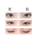 二重埋没 共立美容外科 大宮院 DAY 8 サムネイル用