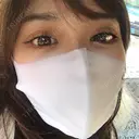 目尻切開 / タレ目形成・グラマラスライン（切開） / 目元修正 A CLINIC（エークリニック） 銀座院 DAY 6 サムネイル用
