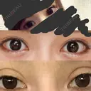 二重切開 / 隆鼻術 / 鼻中隔延長（切開） 牧野皮膚科形成外科内科医院 美容外科・形成外科・抗加齢医学外来 DAY 351 サムネイル用