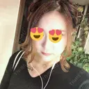 その他（目元） / 糸リフト / ヒアルロン酸注入（涙袋） / ボトックス（あご） / 肌ヒアルロン酸注入（たるみ・シワ改善） / 脂肪溶解注射（顔） 湘南美容クリニック 名古屋院 AFTER サムネイル用