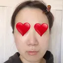 骨切り（あご） / 骨削り（エラ） リラ・クラニオフェイシャル・クリニック DAY 92 サムネイル用