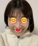 糸リフト / バッカルファット除去 / 脂肪吸引（顔） / ボトックス（エラ・小顔） WOM CLINIC GINZA （ワム クリニック ギンザ） DAY 29 サムネイル用