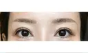 アートメイク（眉） GRACIA clinic 【グラシアクリニック】 DAY 3 サムネイル用