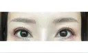 アートメイク（眉） GRACIA clinic 【グラシアクリニック】 DAY 5 サムネイル用