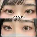 二重切開 / 上まぶたたるみ取り 広島プルミエクリニック AFTER サムネイル用