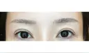 アートメイク（眉） GRACIA clinic 【グラシアクリニック】 DAY 14 サムネイル用