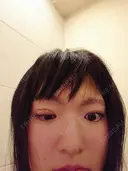 二重埋没 共立美容外科 札幌院 DAY 101 サムネイル用
