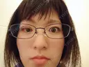 二重埋没 共立美容外科 札幌院 DAY 101 サムネイル用