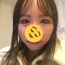 目尻切開 / タレ目形成・グラマラスライン（切開） B-LINE CLINIC 池袋院 DAY 5 サムネイル用