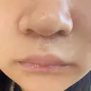 人中短縮 eクリニック 金沢本院 DAY 3 サムネイル用