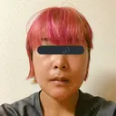 骨切り（あご） / 骨削り（頬） / ルフォー+ssro（両あご) リラ・クラニオフェイシャル・クリニック DAY 21 サムネイル用