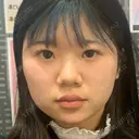 ボトックス（エラ・小顔） / 脂肪溶解注射（顔） 湘南美容クリニック 宇都宮院 DAY 0 サムネイル用