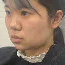 ボトックス（エラ・小顔） / 脂肪溶解注射（顔） 湘南美容クリニック 宇都宮院 DAY 0 サムネイル用