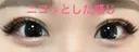 二重埋没 湘南美容クリニック 松山院 DAY 24 サムネイル用