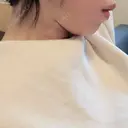 脂肪吸引（顔） 北尾クリニック DAY 25 サムネイル用