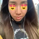 ピーリング（ニキビ・毛穴） / ダーマペン TRUE DESIGN CLINIC AFTER サムネイル用