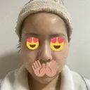 ヒアルロン酸注入（鼻） アクトリー勝どきウェルネスメディカルクリニック DAY 3 サムネイル用