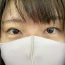 眼瞼下垂（切開） くさのたろうクリニック DAY 105 サムネイル用