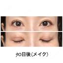 二重切開 / 目元修正 ビスポーククリニック 福岡院 DAY 90 サムネイル用