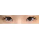 二重埋没 湘南美容クリニック 宇都宮院 AFTER サムネイル用