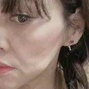 クマ治療 / バッカルファット除去 / 額を丸く / 下まぶたたるみ取り / 下まぶたの脂肪取り / タレ目形成・グラマラスライン（切開） / 脂肪注入（額） / 切開リフト / 脂肪注入（輪郭） / その他（口元） アマソラクリニック DAY 173 サムネイル用
