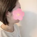 脂肪吸引（顔） 北尾クリニック DAY 33 サムネイル用