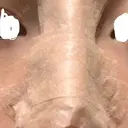 隆鼻術 アネシス美容クリニック DAY 0 サムネイル用