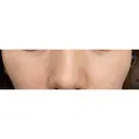 シミ取りレーザー / ピコレーザートーニング（美白・肝斑） UB CLINIC銀座 DAY 6 サムネイル用