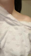 ボトックス（肩） 品川スキンクリニック 宇都宮院（※品川美容外科提携） DAY 9 サムネイル用