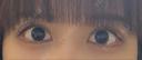 二重切開 / 上まぶたたるみ取り 酒井形成外科 DAY 21 サムネイル用