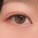 二重埋没 / 上まぶたの脂肪取り 湘南美容クリニック 水戸院 DAY 34 サムネイル用