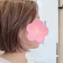 脂肪吸引（顔） 北尾クリニック DAY 41 サムネイル用