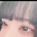 ヒアルロン酸注入（涙袋） イデア美容皮膚科クリニック 千葉船橋院 DAY 0 サムネイル用