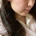 糸リフト / ボトックス（あご） / 肌ヒアルロン酸注入（たるみ・シワ改善） / ヒアルロン酸注入（あご） / ヒアルロン酸注入（唇） / ボトックス（口角） ルラ美容クリニック 新宿院 DAY 5 サムネイル用