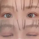 二重切開 EMMA CLINIC（エマクリニック） DAY 27 サムネイル用