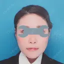 骨切り（あご） / 骨削り（頬） / ルフォー+ssro（両あご) リラ・クラニオフェイシャル・クリニック AFTER サムネイル用