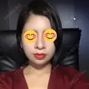 隆鼻術 / 鼻尖形成（切開） / 鼻中隔延長（切開） / 骨切幅寄せ 表参道スキンクリニック 表参道院 DAY 39 サムネイル用