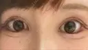 目尻切開 / タレ目形成・グラマラスライン（切開） ビスポーククリニック 福岡院 DAY 19 サムネイル用